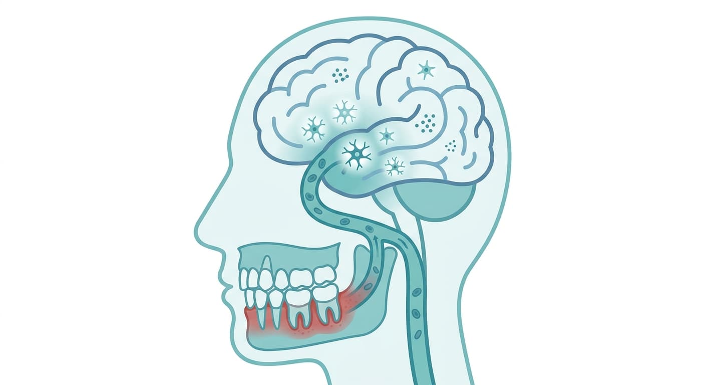 Corte transversal de una cabeza que muestra la vía desde los dientes y las encías, a través de los vasos sanguíneos, hasta el cerebro, con células inmunitarias en forma de estrella en el interior del cerebro