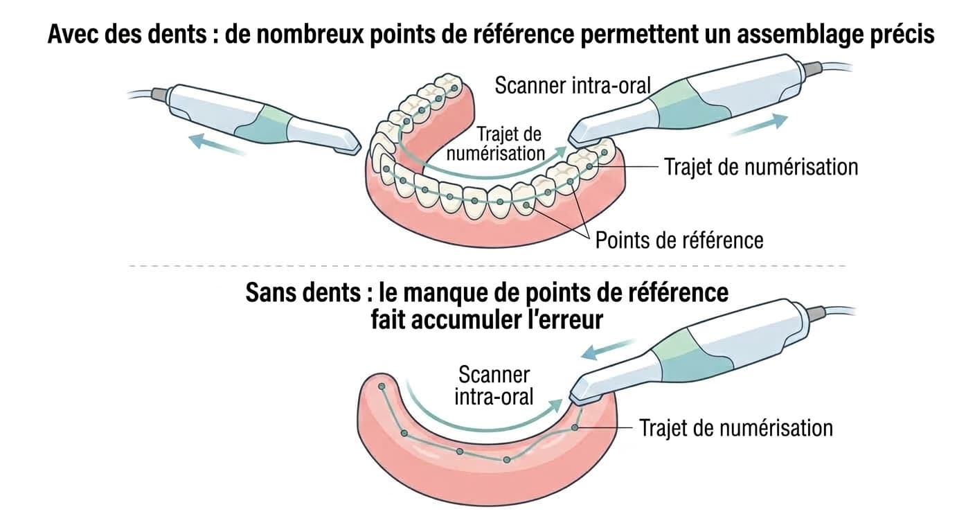Illustration comparant la façon dont le trajet de numérisation du scanner intra-oral suit les points de référence, selon que des dents sont présentes ou absentes.