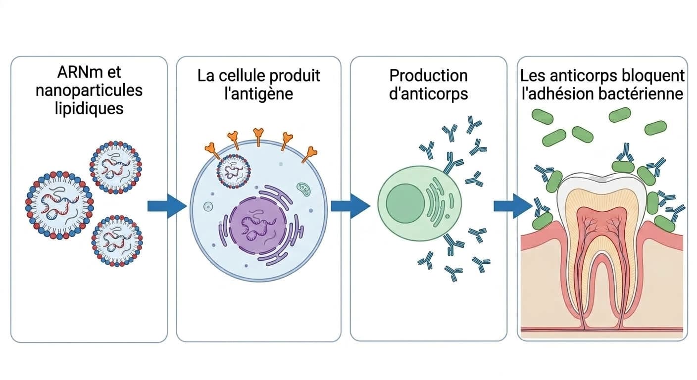 Illustration en quatre étapes montrant comment l'ARNm encapsulé dans des nanoparticules lipidiques pénètre dans une cellule pour produire un antigène, reconnu par les cellules immunitaires qui fabriquent des anticorps bloquant l'adhésion des bactéries à la surface des dents.