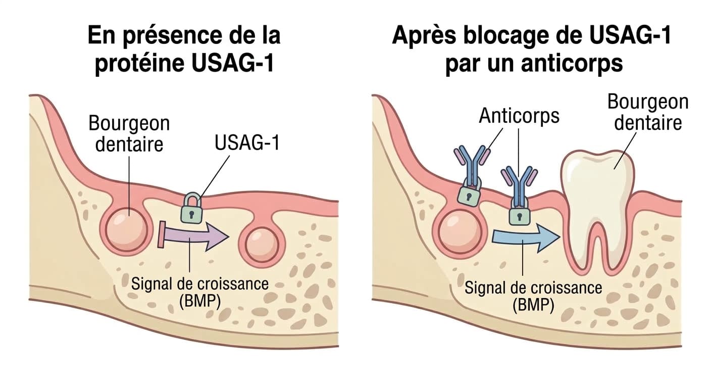 Illustration comparant le mécanisme par lequel la protéine USAG-1 bloque le signal de croissance du bourgeon dentaire et le processus par lequel l'anticorps la neutralise pour permettre au bourgeon dentaire de recommencer à croître