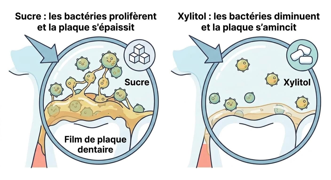 Illustration comparant le mécanisme par lequel le sucre fait proliférer les bactéries et épaissir la plaque dentaire, et celui par lequel le xylitol réduit les bactéries et amincit la plaque