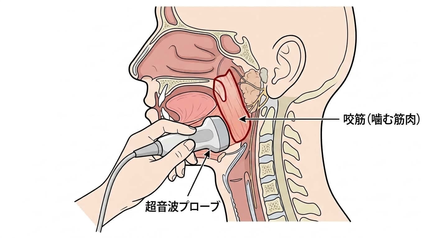 咬筋の位置と、超音波プローブで厚さを測定する部位を示す解剖図解
