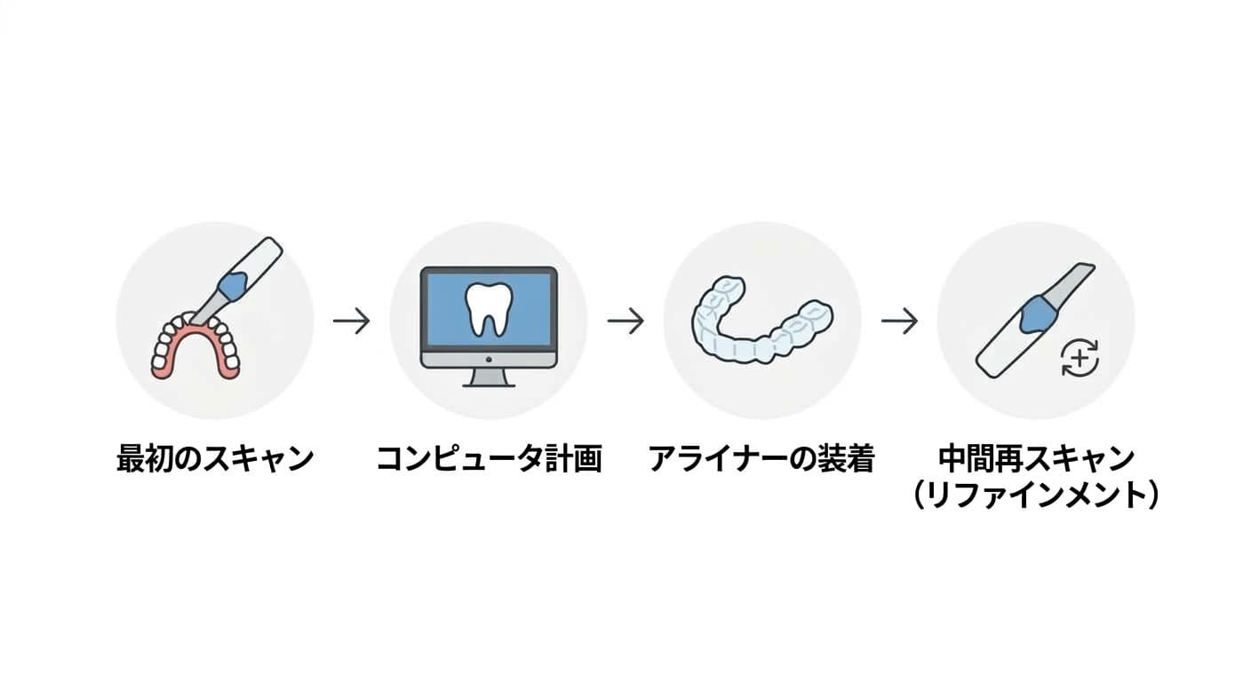 スキャン、コンピューター計画、アライナー装着、途中の再スキャン(リファインメント)へと続く治療の流れを示すフローチャート