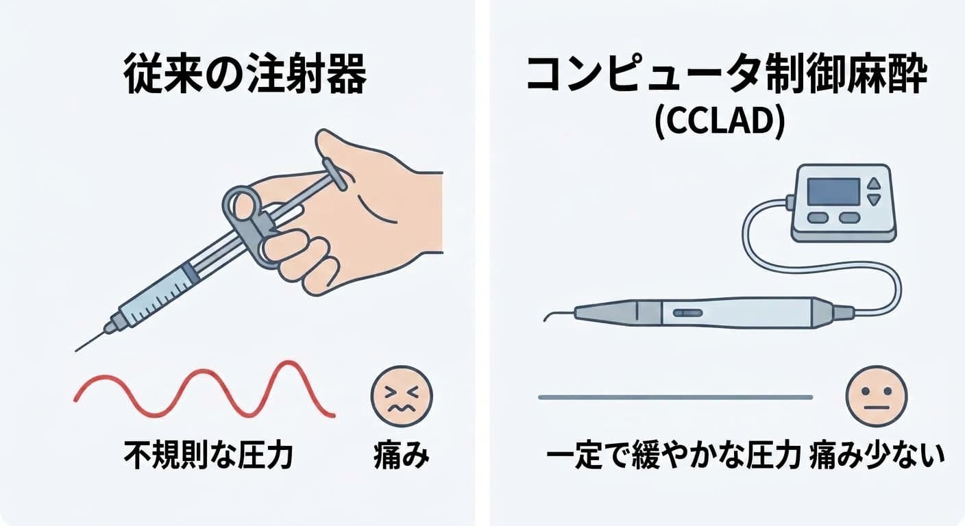 従来の注射器は手で押すため圧力が不規則で痛みが大きいが、コンピュータ制御麻酔装置は一定で緩やかな圧力により痛みが少ないことを示す比較図