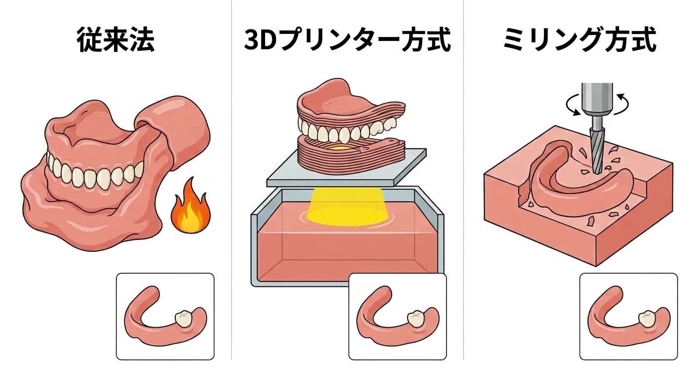 入れ歯を作る三つの方法を並べて比較した図。左は生地状のレジンに歯を埋め込み熱で硬化させる従来法、中央は液体レジンを層状に積み重ねて硬化させる3Dプリンター方式、右は硬いブロックを切削刃で削り出すミリング方式を示す