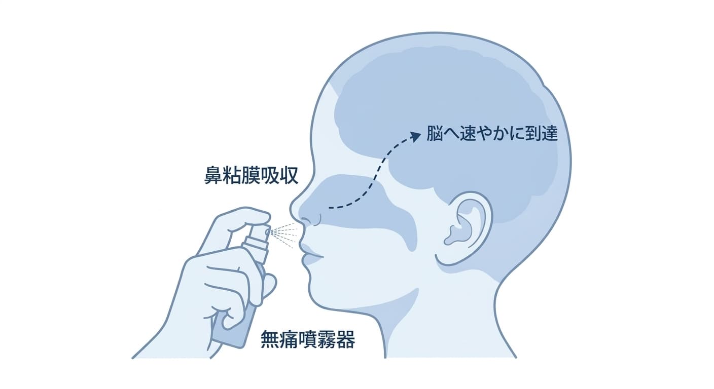噴霧器で鼻の中に鎮静剤をスプレーすると、鼻粘膜を通じて速やかに吸収され、脳へ伝わる過程を示した図