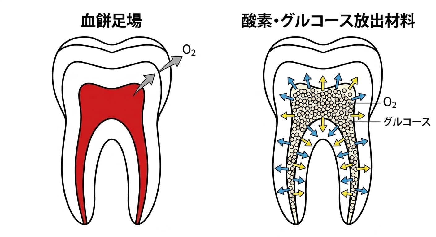 従来の再生歯内療法の血餅足場と、根管全体に酸素・グルコースを均一に行き渡らせる新素材を比較した歯の断面模式図