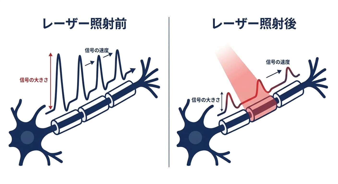 レーザー照射の前後で神経線維を伝わる電気信号の大きさと速度の変化を比較した図