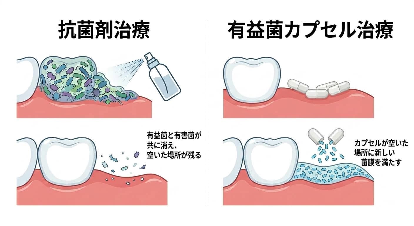 抗菌剤治療と有益菌カプセル治療を左右で比較した図。抗菌剤は細菌をなくして空いた場所を残し、カプセルは空いた場所に新しい菌膜を満たす