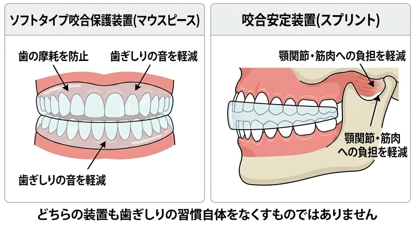 ソフトタイプ咬合保護装置と咬合安定装置を並べて比較し、それぞれ歯の摩耗・音の軽減と顎関節・筋肉の負担軽減という異なる目的を示す図