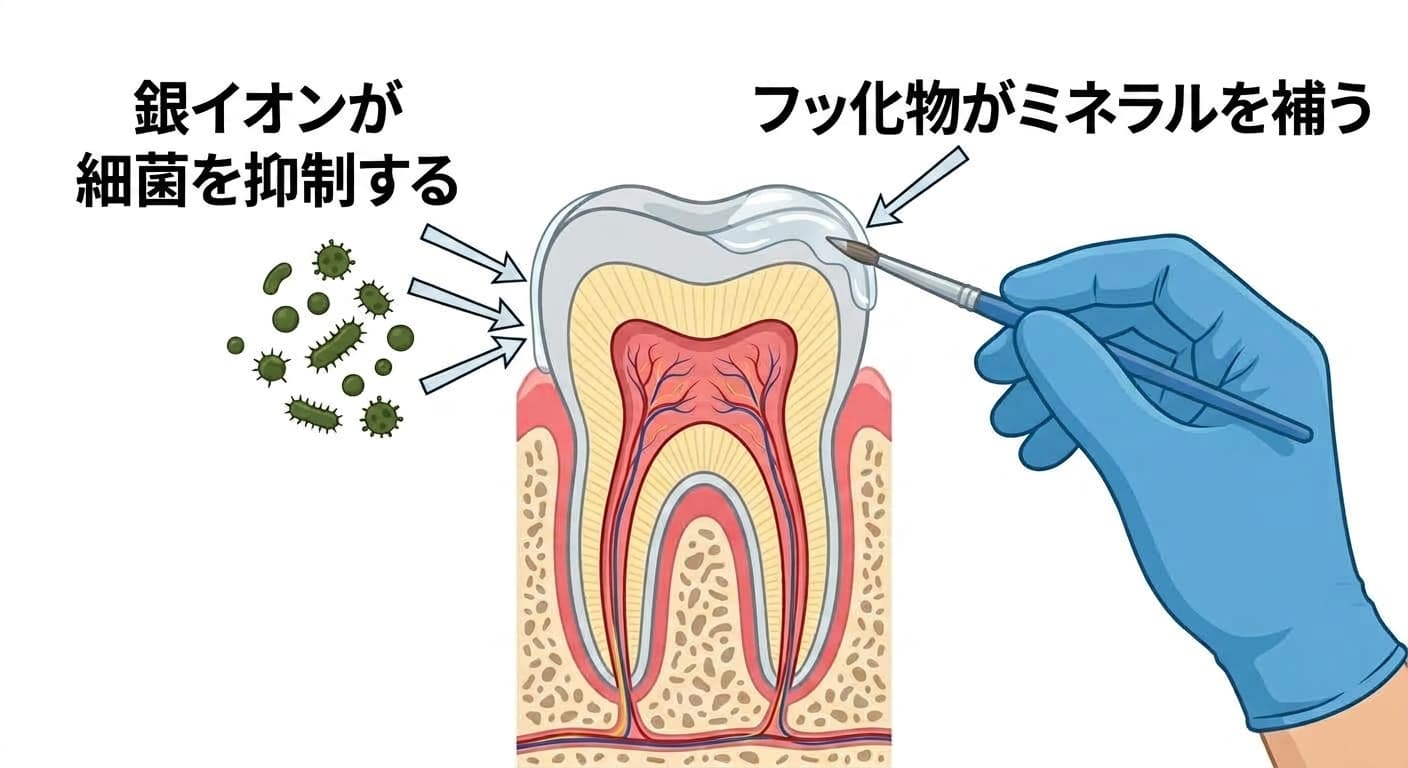 歯の表面に塗布液を塗る手とともに、銀イオンが細菌を抑制する作用とフッ素が失われたミネラルを補う作用を矢印で示した図。