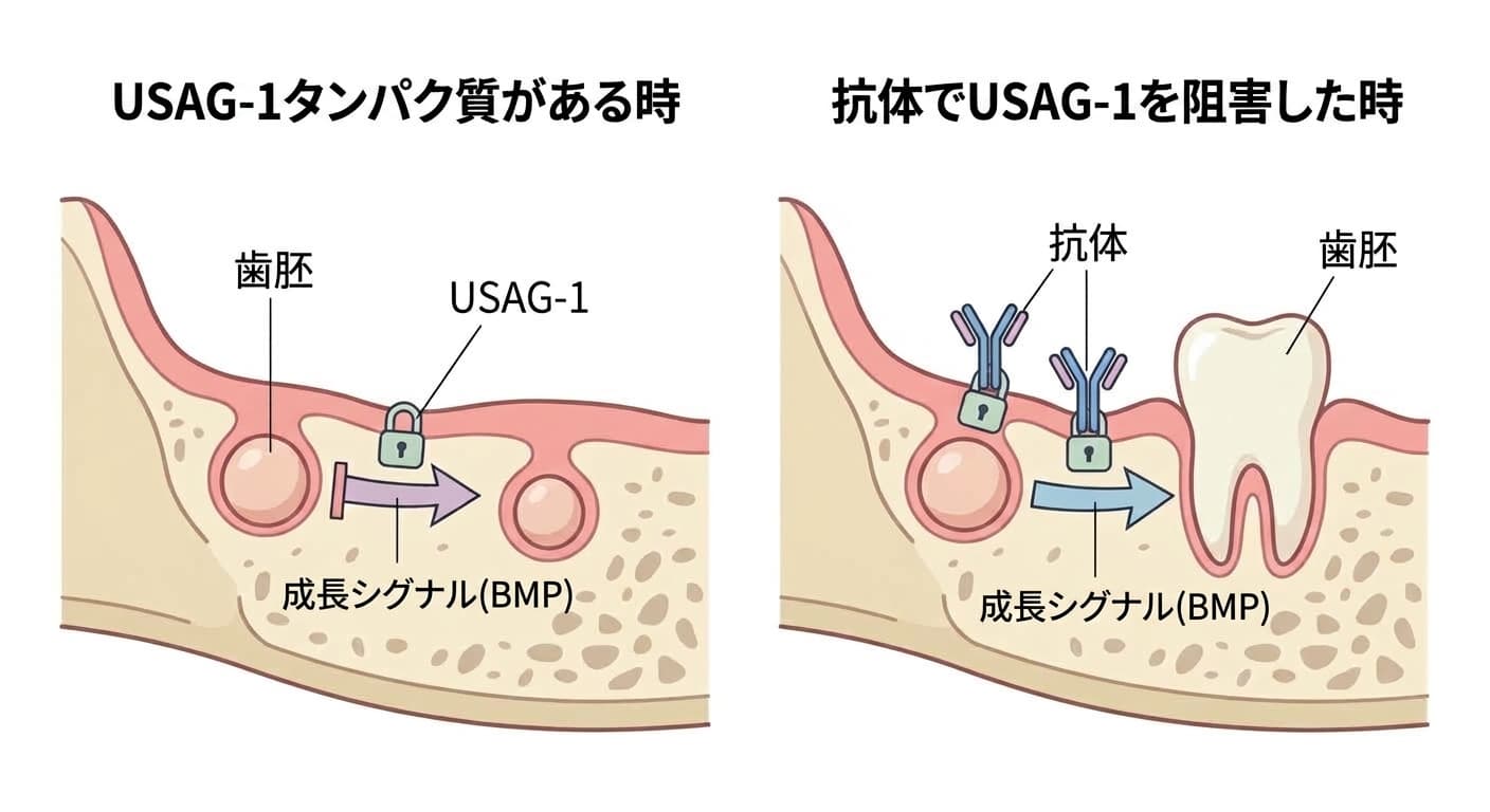 USAG-1タンパク質が歯胚の成長シグナルを妨げる仕組みと、抗体がこれを無力化して歯胚が再び成長する過程を比較した図