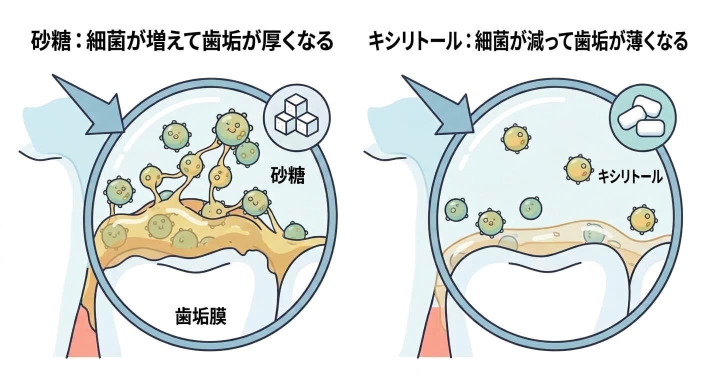 砂糖は細菌を増やして歯垢を厚くし、キシリトールは細菌を減らして歯垢を薄くする仕組みを比較した図