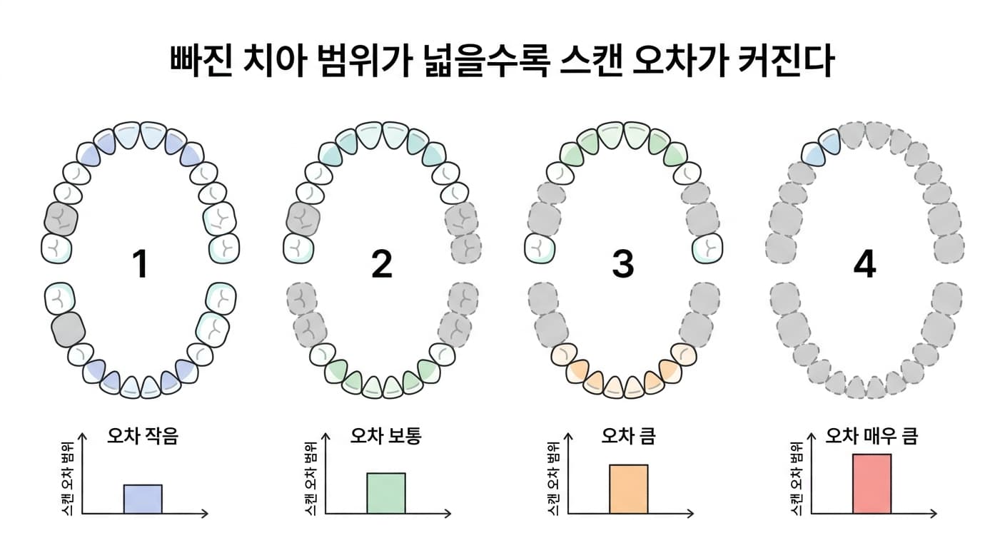 빠진 치아의 범위가 넓어질수록 스캔 오차가 커지는 정도를 네 단계로 보여주는 그림. 치아가 조금 빠졌을 때는 오차가 작고 치아가 거의 다 빠졌을 때는 오차가 크다