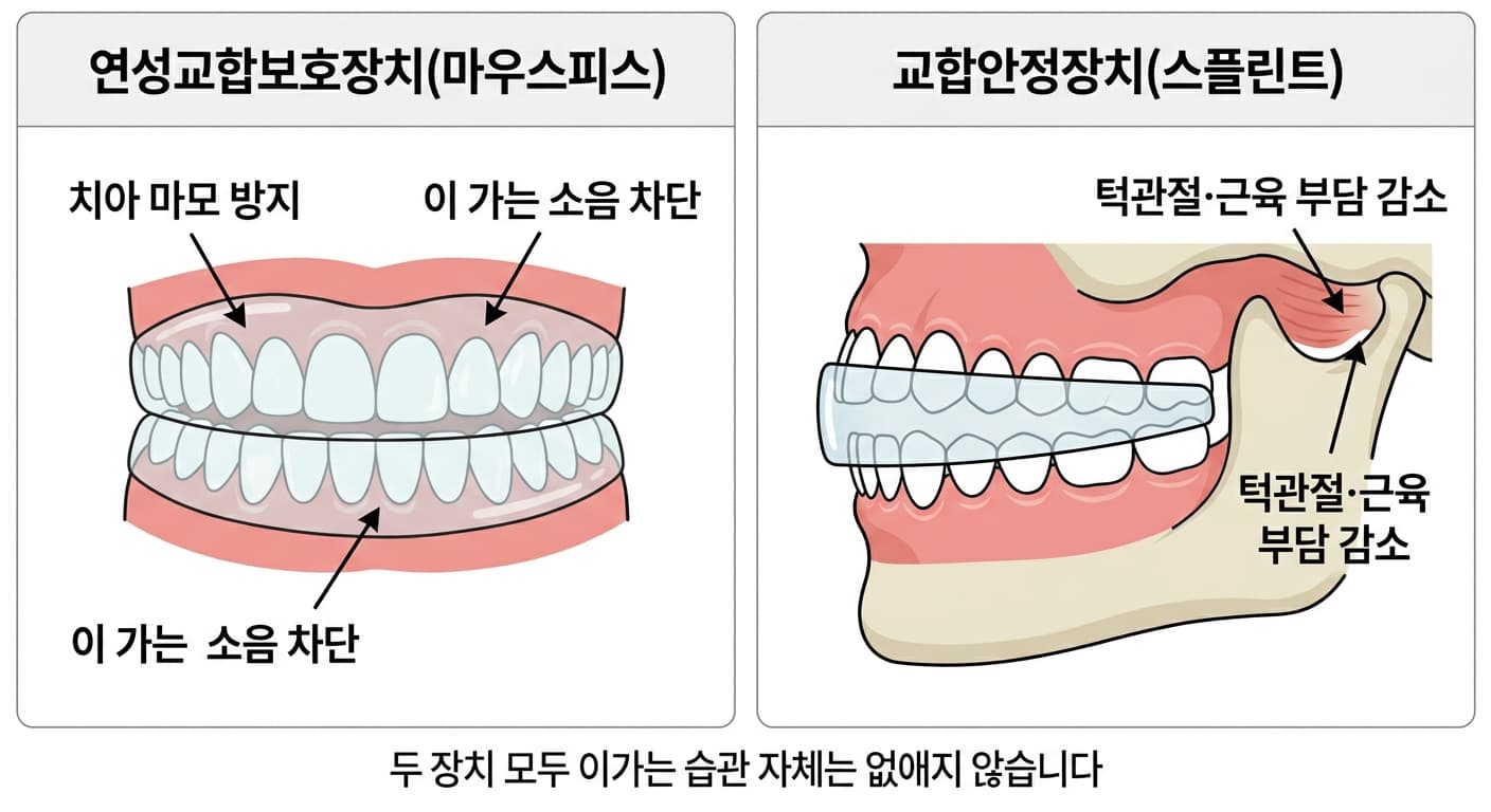 연성교합보호장치와 교합안정장치를 나란히 비교해 각각 치아 마모·소음 차단과 턱관절·근육 부담 감소라는 다른 목적을 보여주는 그림
