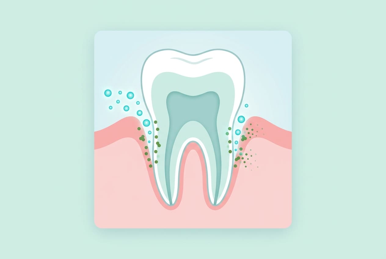 Adding Ozone Gas to Periodontitis Scaling Shrank Pockets Further, but Bleeding Stayed the Same