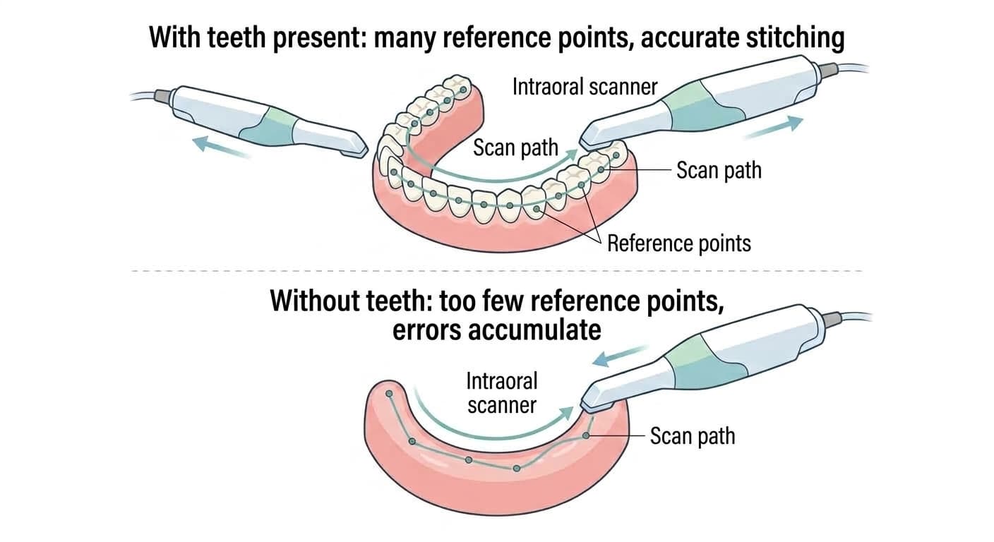 An illustration comparing how the intraoral scanner's scan path follows reference points differently when teeth are present versus absent