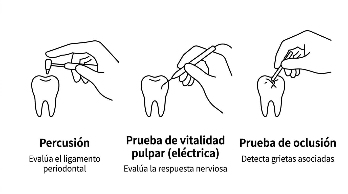 Ilustración del proceso de evaluación: la percusión para el estado del ligamento periodontal, la prueba de vitalidad pulpar eléctrica para la respuesta nerviosa y la prueba de oclusión para detectar grietas asociadas