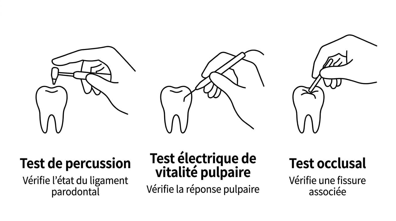 Illustration montrant le test de percussion pour évaluer le ligament parodontal, le test de vitalité pulpaire électrique pour la réponse nerveuse et le test occlusal pour une fissure associée