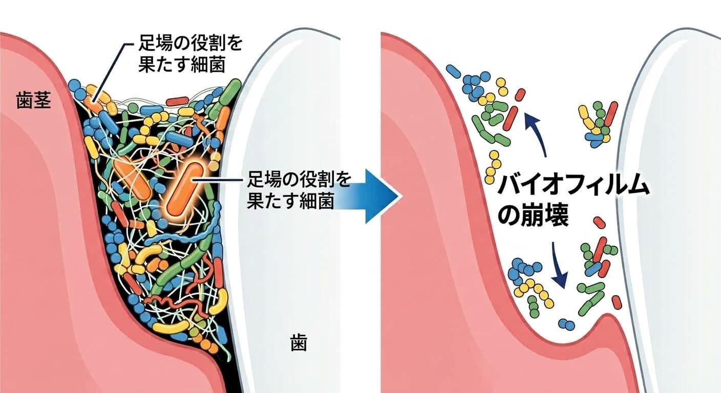 歯肉溝の中のバイオフィルムで足場の役割を果たす細菌一つが消えると、残りの細菌が散らばりバイオフィルム全体が崩壊する概念図