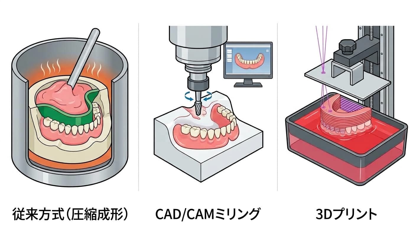 義歯を作る3つの方法である従来の圧縮成形、CAD/CAMミリング、3Dプリントの製作過程を並べて示す図