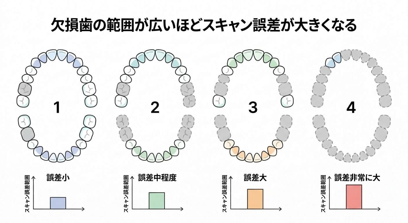 欠損歯の範囲が広がるほどスキャン誤差が大きくなる程度を4段階で示した図。歯が少し欠損しているときは誤差が小さく、歯がほとんど欠損しているときは誤差が大きい