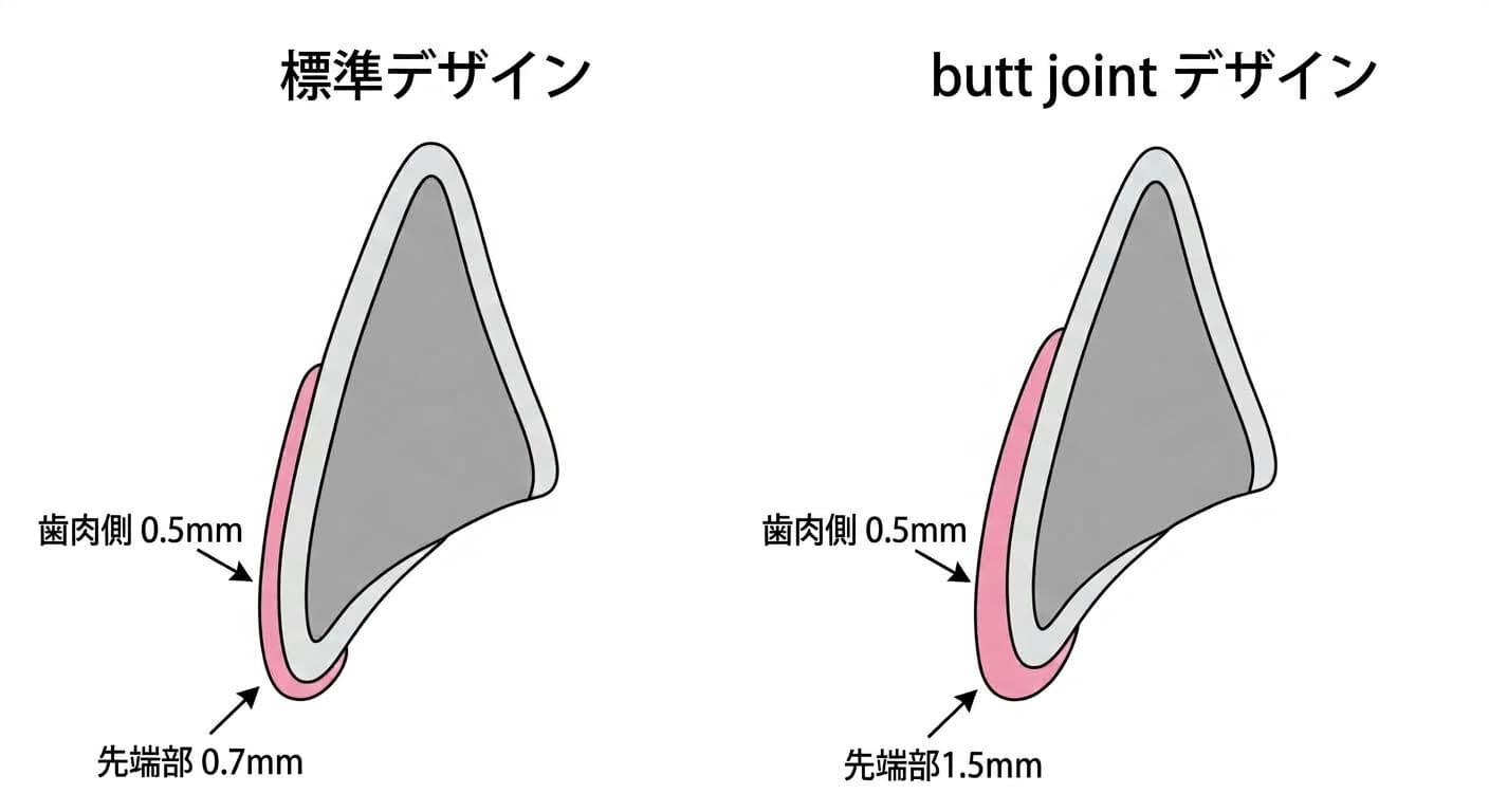ラミネートの切端デザイン別の削合厚さ比較。標準デザインは歯肉側0.5mm、先端部0.7mmを削合し、butt jointデザインは歯肉側0.5mm、先端部1.5mmを削合する