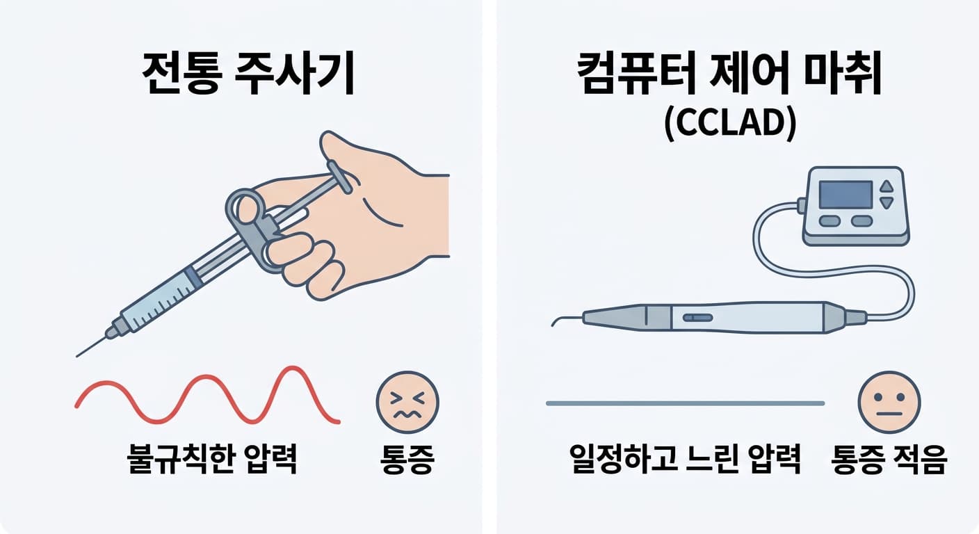 전통 주사기는 손으로 눌러 압력이 불규칙하고 통증이 크지만 컴퓨터 제어 마취 장치는 일정하고 느린 압력으로 통증이 적다는 것을 보여주는 비교 그림