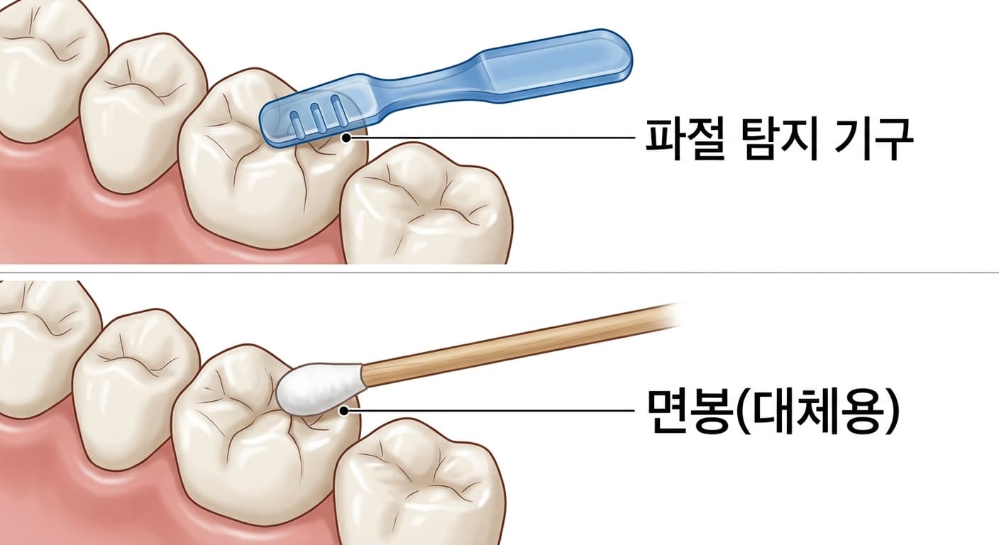 치아 균열 여부를 확인하는 파절 탐지 기구와 대체용 면봉을 비교한 그림