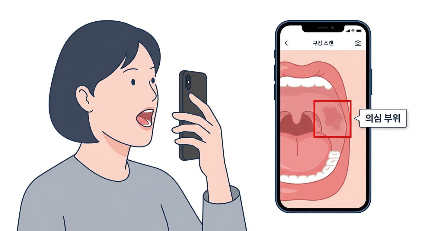 스마트폰으로 입안을 촬영하면 AI가 화면 속 의심 병변 부위를 빨간 테두리로 표시하는 개념도