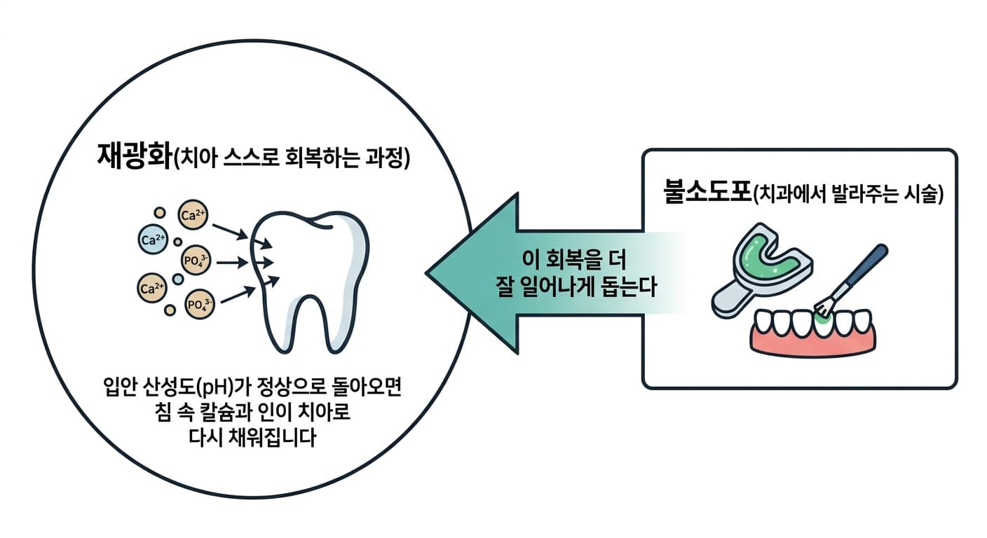 치아 스스로 회복하는 재광화 과정과, 그것을 돕는 시술인 불소도포의 관계를 화살표로 보여주는 그림. 왼쪽 원 안에는 칼슘·인 이온이 치아 표면으로 다시 붙는 재광화 과정이, 오른쪽 상자 안에는 치과에서 불소 젤을 발라주는 모습이 그려져 있고, 불소도포가 재광화를 돕는다는 화살표로 연결되어 있습니다.