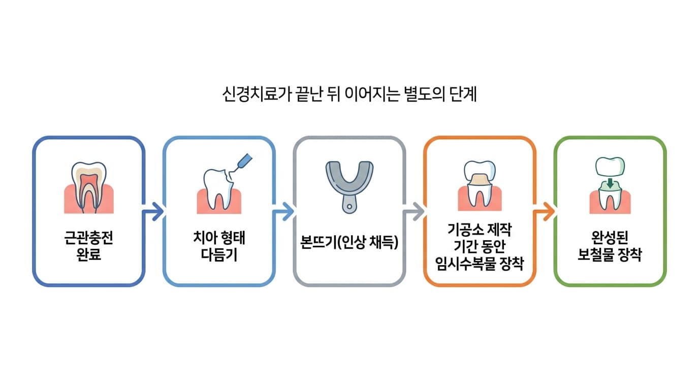 신경치료가 끝난 뒤 이어지는 별도의 단계를 보여주는 순서도. 근관충전 완료, 치아 형태 다듬기, 본뜨기, 기공소 제작 기간 동안 임시수복물 장착, 완성된 보철물 장착 순서로 진행된다