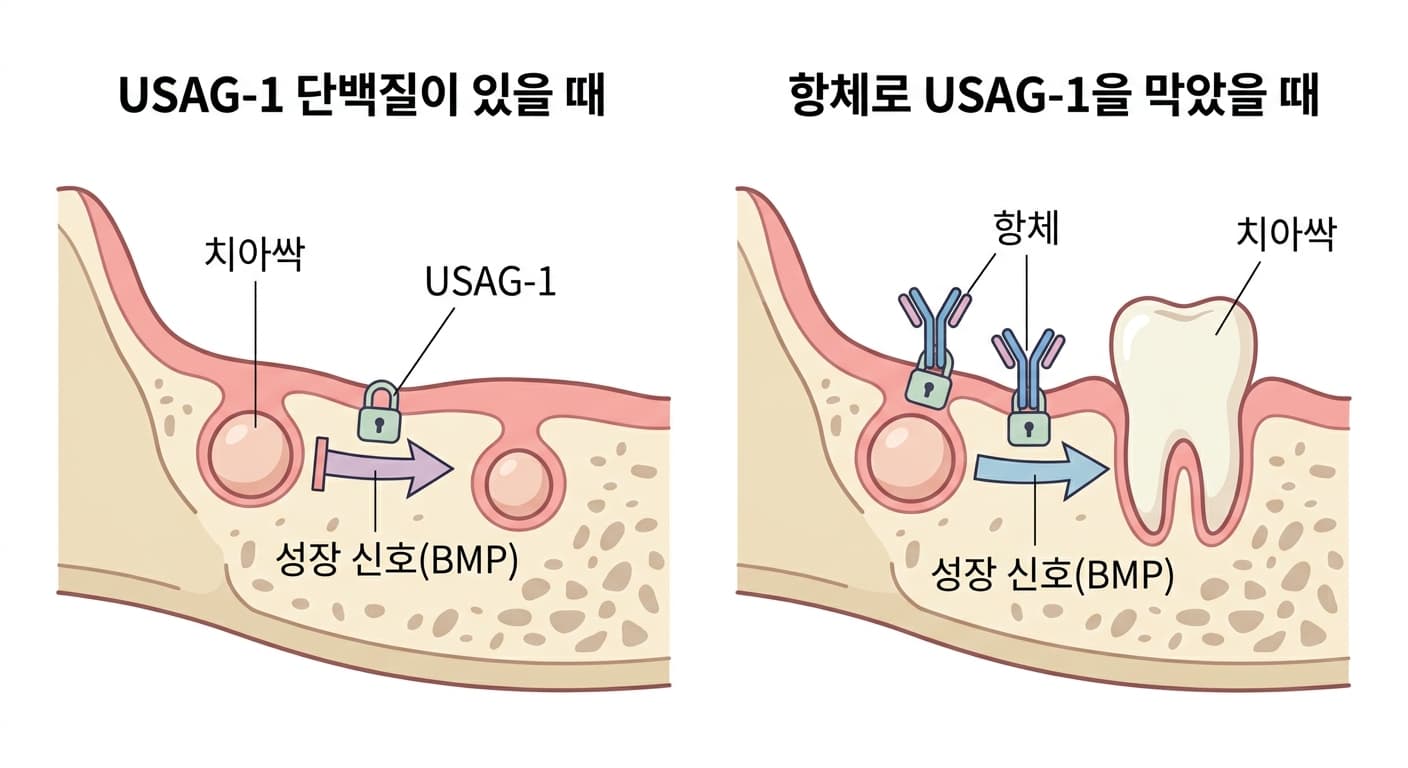 USAG-1 단백질이 치아싹의 성장 신호를 막는 원리와 항체가 이를 무력화해 치아싹이 다시 자라는 과정을 비교한 그림