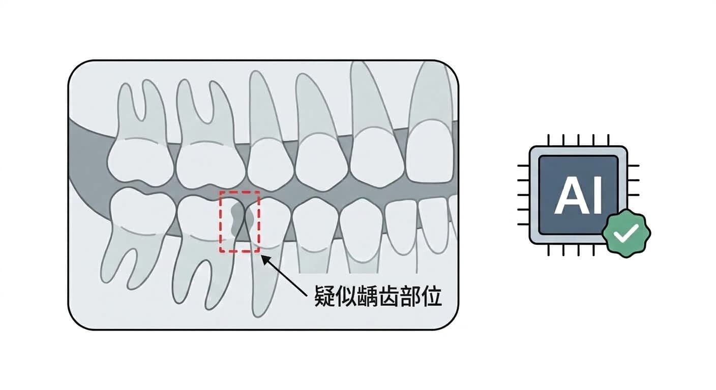 AI在牙科X光片上标记疑似龋齿部位的示意图