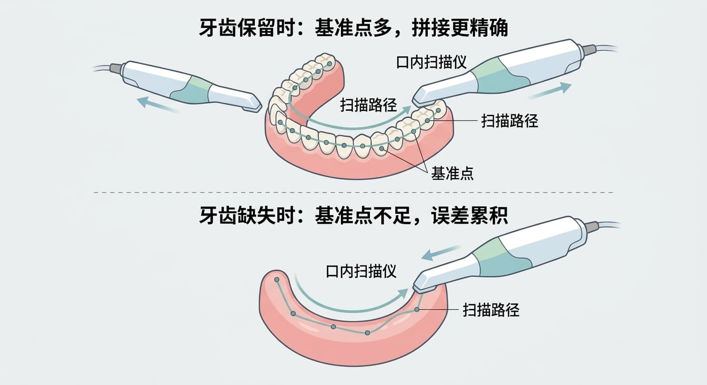 比较牙齿保留与缺失时,口内扫描仪沿基准点连接扫描路径的方式有何不同的图示