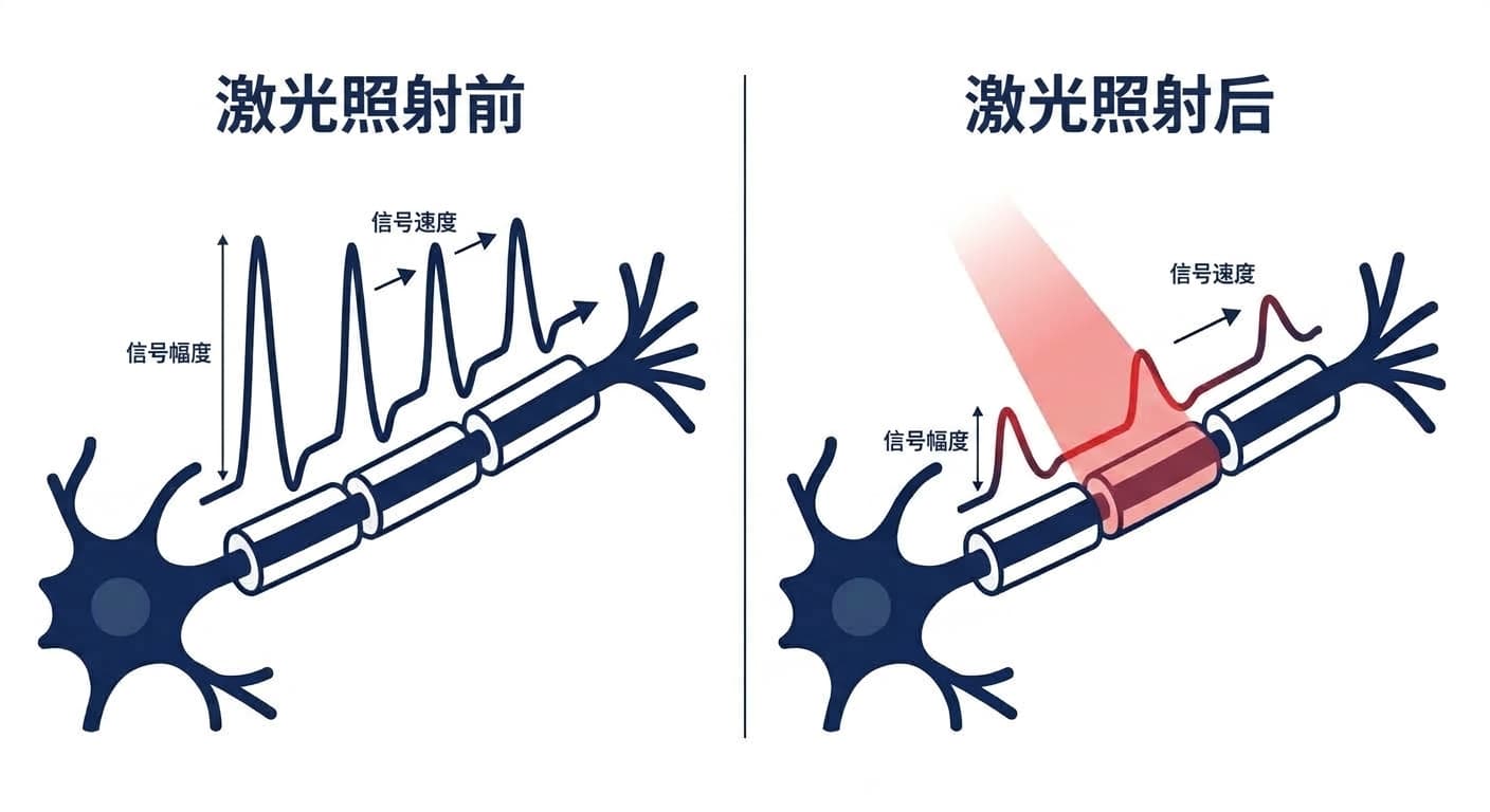 对比激光照射前后神经纤维中电信号幅度与传导速度变化的示意图