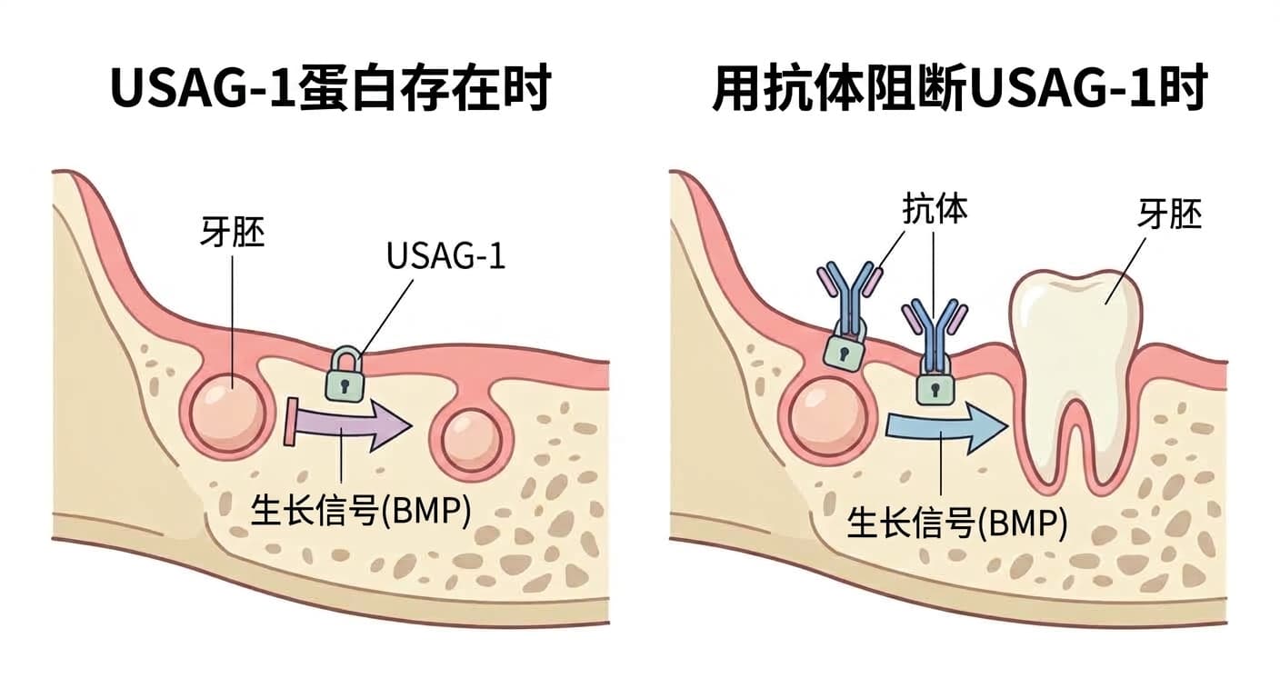 USAG-1蛋白阻断牙胚生长信号的原理,与抗体使其失效后牙胚重新生长过程的对比图