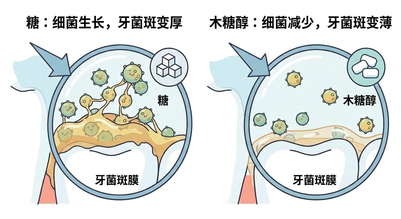 比较糖增加细菌使牙菌斑变厚,木糖醇减少细菌使牙菌斑变薄的原理示意图